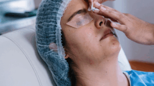 Augenlasern Heilungsverlauf